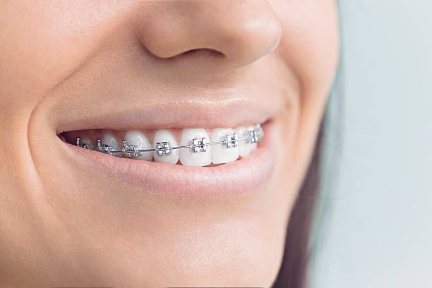 Best Dental Fillings (Composite and Amalgam)  in Amberley, OH
